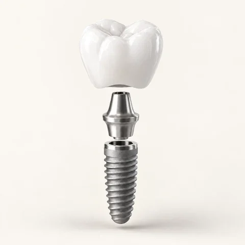 Concept illustration of the implant, abutment and crown